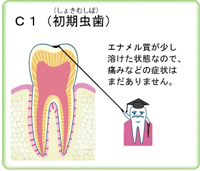 c1